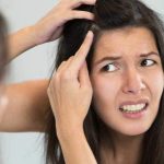 How to Get Rid of Dandruff Naturally at Home