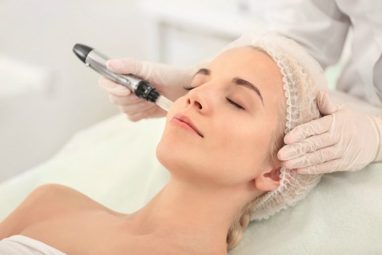 The Top 5 Things To Know Before Microneedling